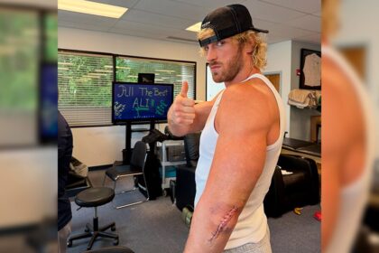Logan Paul após cirurgia